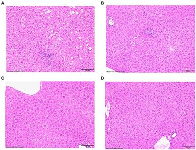 Sexual dimorphism in hepatic PPAR alpha and CYP4a12a expression is associated with reduced development of drug-induced non-alcoholic steatohepatitis in female IL-33−/− mice